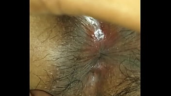 Gaping Brown Anus